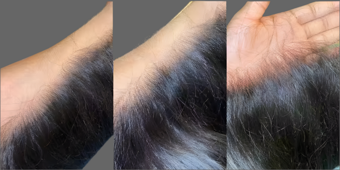 5x5 HD Lace Closure – Premium Unprocessed Hair-Ready to Wear